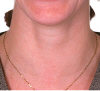 neck